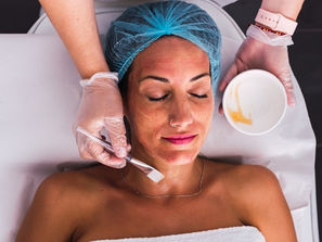 Peel Back The Fear: Unlocking The Power Of Peels