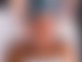 Peel Back The Fear: Unlocking The Power Of Peels