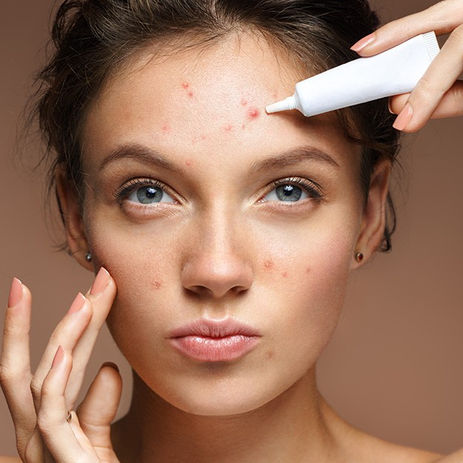 The Blemish Questions: What Exactly & How Long Do They Last?