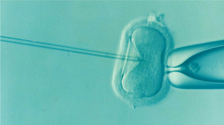 Egg Freezing