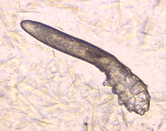 demodex.gif
