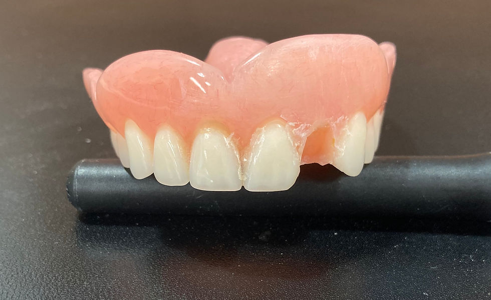 Missing tooth