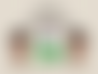 Botox Results in Dallas, TX | Different Between Week 1 and Week 4