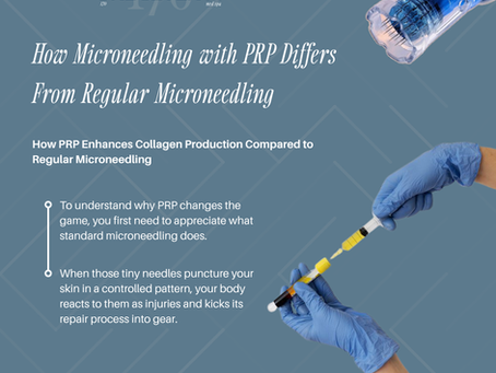 PRP vs Regular Microneedling in Dallas, TX: Which Gives Better Results?