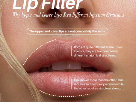 Lip Filler in Dallas, TX | Why Upper and Lower Lips Are Treated Differently