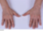 before-hand-treatment