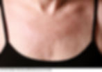 after-decollette-pad
