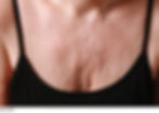 before-decollette-pad