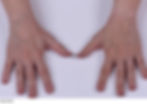 before-hand-treatment