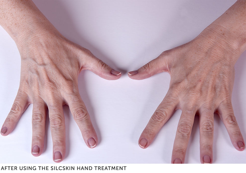 after-hand-treatment