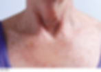 before-collette-pad