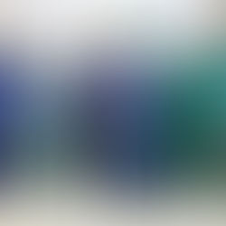 Santa Casa de Formiga realiza procedimento cardíaco inédito