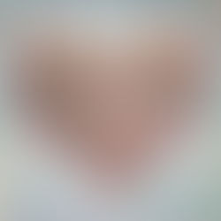 Santa Casa de Formiga luta para reativar UTI Neonatal e manter outros serviços