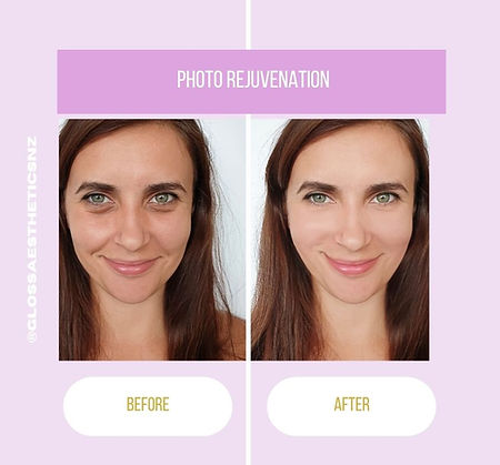 Copy of Purple Peach Minimalist Before And After Skincare Pink and Purple Facebook Post.jp