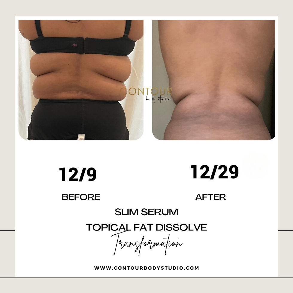 Thumbnail: Slim Serum - Topical Fat Dissolve