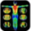 thermography.webp