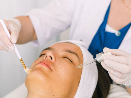 Chemical Peels: The Complete Guide to Brighter, Smoother Skin