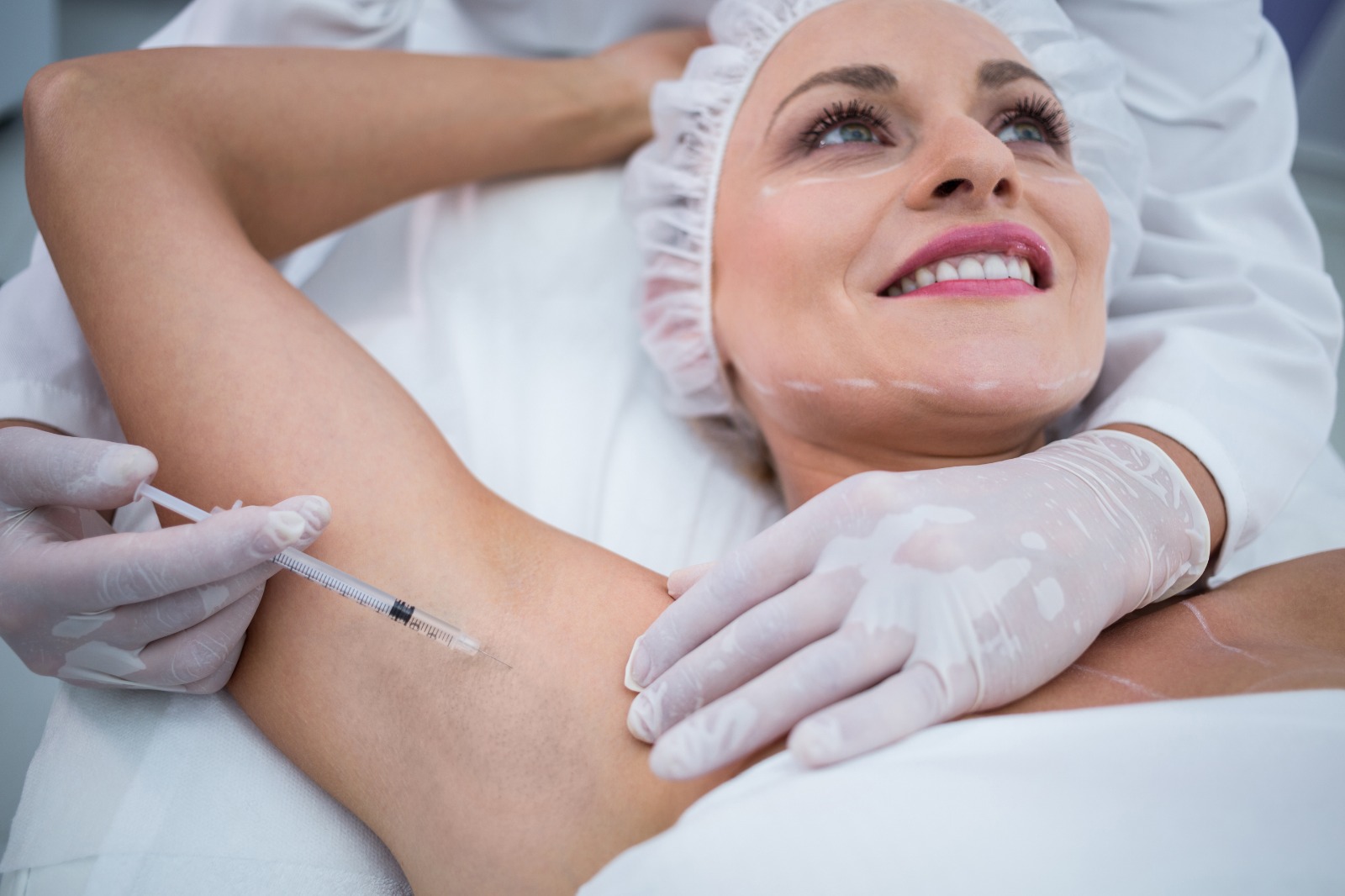 Underarm Botox and Dysport injections for hyperhidrosis in North York at Sonia Cosmetic Clinic