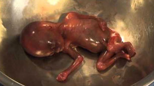 Video: Democrats Supporting 'Abortions Without ANY Limits'