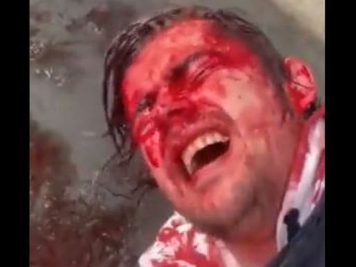 Australian Police Brutally Crack-Down on Orange Vest Protesters for Having 'the Wrong Opinion'.