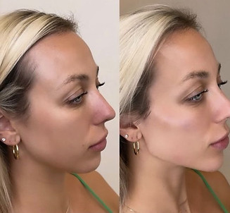 Full Face Contour.jpg