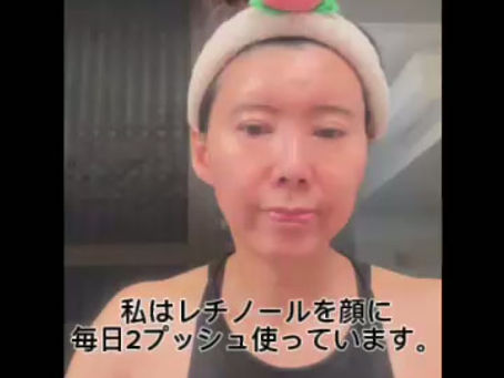 レチノール歴2年半でもまだピリピリする時があります