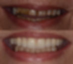 Darlene Before and After