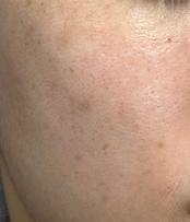 White modern Before After Instagram Post.zip - 15.png