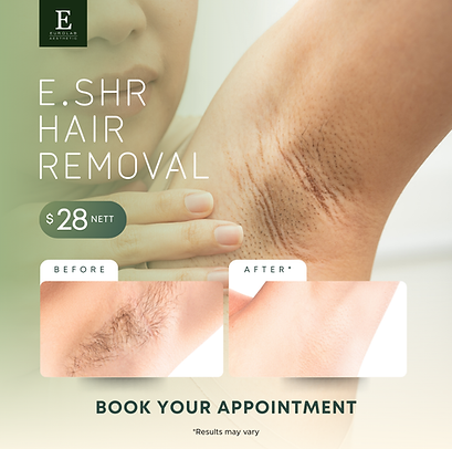 Eurolab - Template fr Before after (1080 x 1080 px) 250926.png