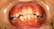 903_平田 琳子_20080609_画像 口腔内写真_正面.jpg