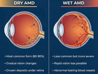 Dry AMD vs. Wet AMD: What's the Difference?