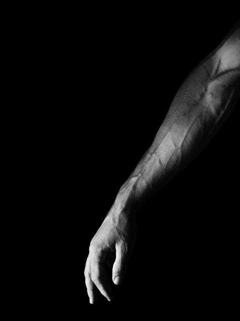 Brachioplasty