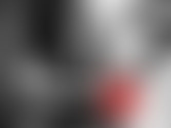 Is Anxiety or Stress Causing Your Back Pain?