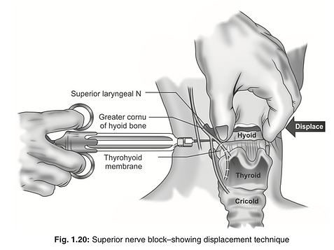 Fig 0120.png