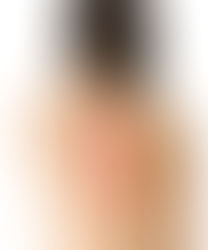 ぎっくり背中・突然来る、寝違えたような背中の痛みの治し方・対処法・・・きとう健康院