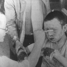 The War Orphans of Hiroshima: Part IV
