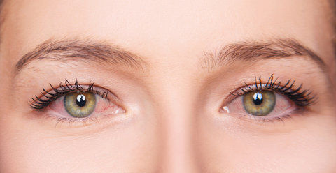Lady with red irritated eyes
