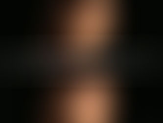 Rinoplasti Nedir? Uzman Görüşüyle Türkiye’de Burun Estetiği Rehberi