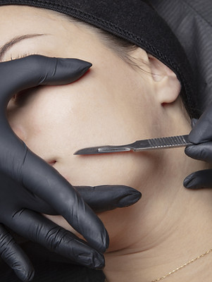 AdobeStock_323990901-Dermaplaning.jpeg