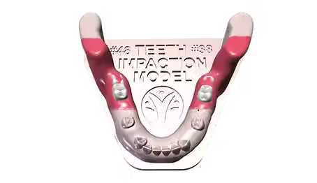 Understanding the Impaction Model: A Key Tool in Dental Education