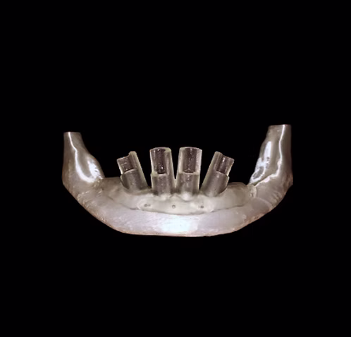 Basic Implant Surgical Guide
