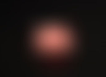 GBR Guided Bone Regeneration Model – Elevating Dental Training