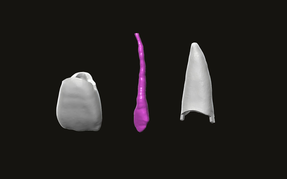 Thumbnail: Endo Tooth #11