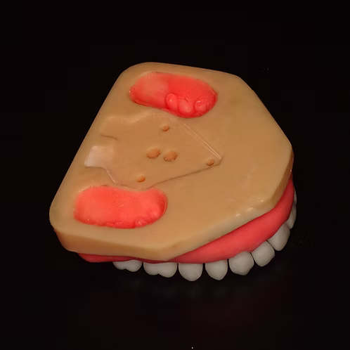 Completely Dentulous Maxillary