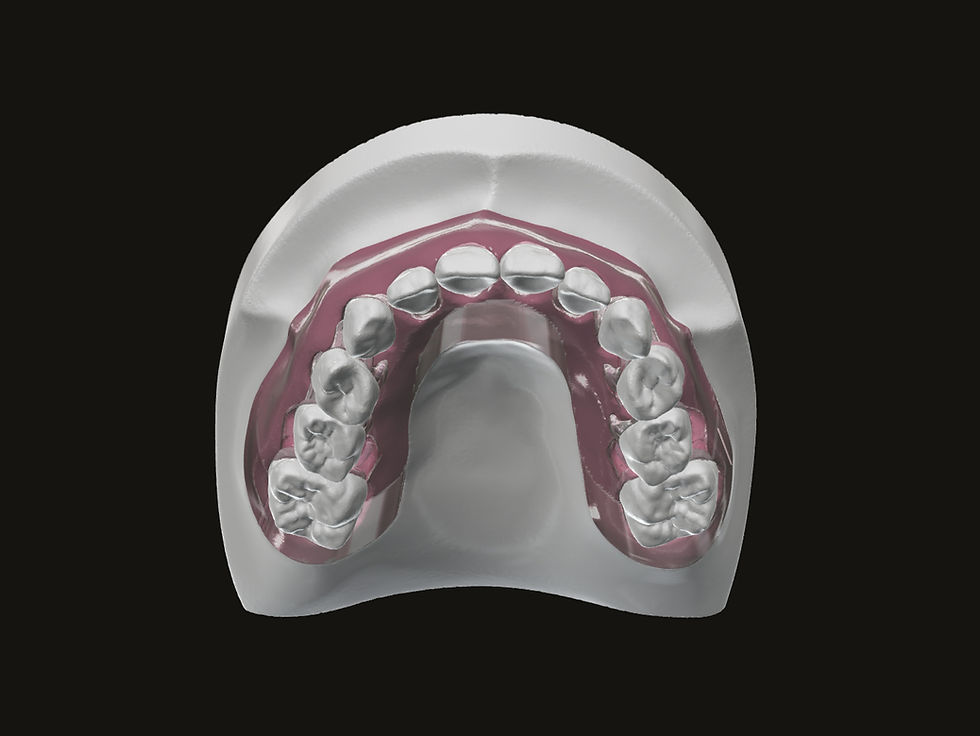 Thumbnail: Pedo Endo Hand-On Model Full Arch Upper Teeth with Base