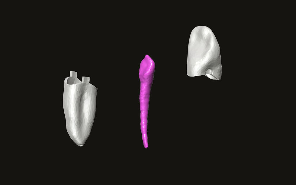 Thumbnail: Endo Tooth #43