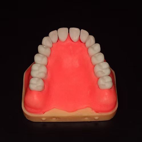 Completely Dentulous Maxillary