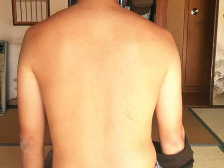 八王子市の宇津木台たにあい整骨院の治療について