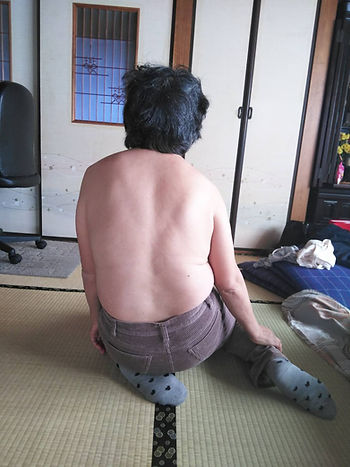 治療前