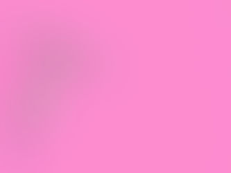 Stérilet Hormonal ou SIU